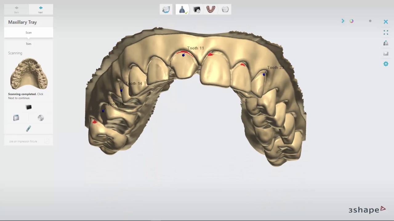3Shape impression scanning