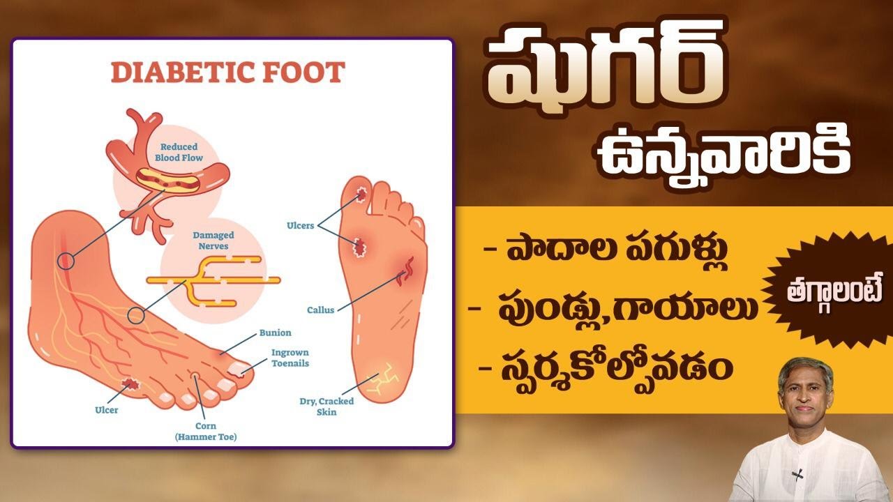 Diabetic Foot Care | Reduce Wounds and Cracked Heels | Healing Power | Dr.Manthena's Health Tips