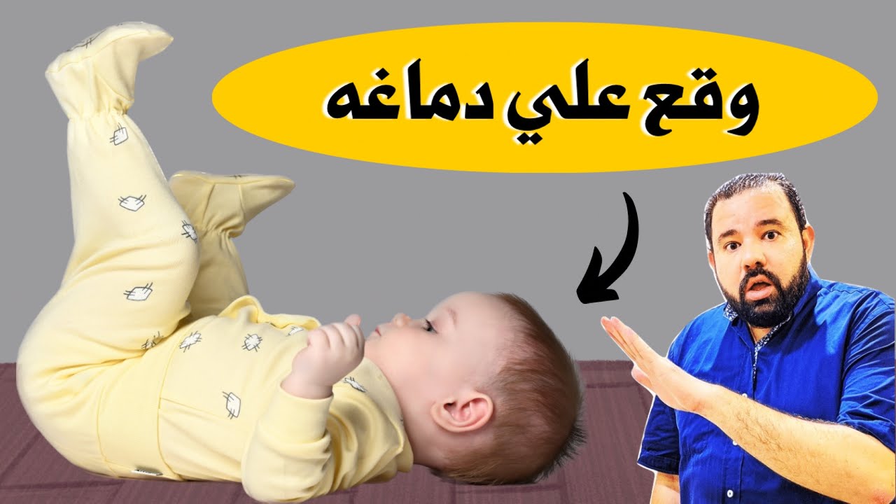 انتبهوا ‼️ لما ابنك يقع علي راسه او يتخبط في دماغه لازم تعملي كده بسرعة || سقوط الطفل علي راسه