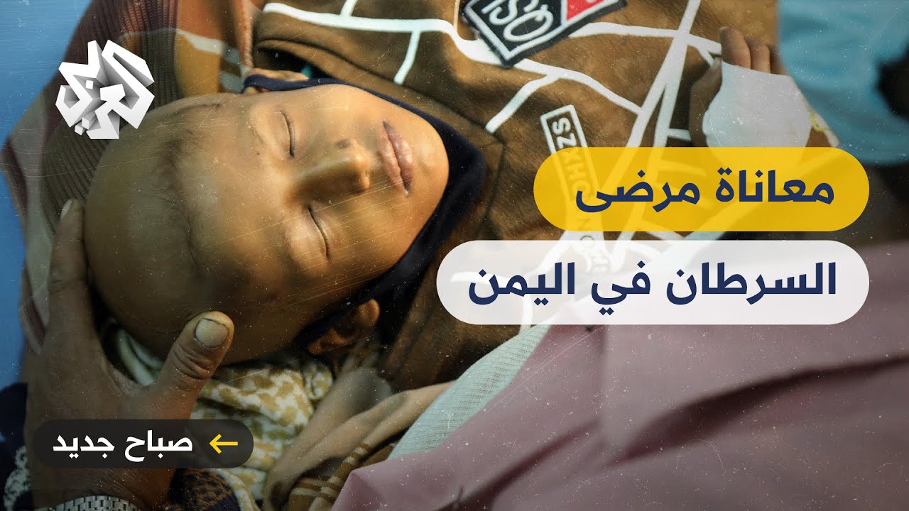 ارتفاع تكاليف العلاج يفاقم معاناة مرضى السرطان في اليمن