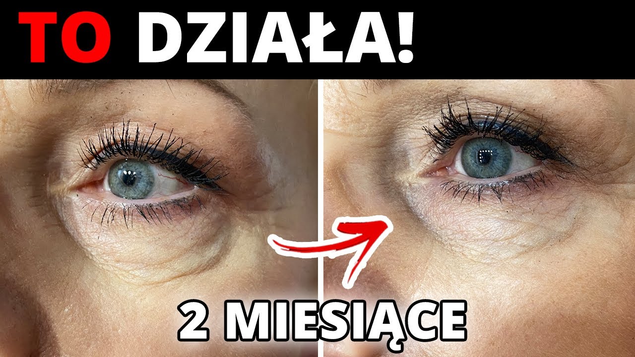 KREM CUDO 😍 pod oczy * do twarzy * ZABIEG na trądzik = HITY TESTEREK 💪 rozdanie 🎁