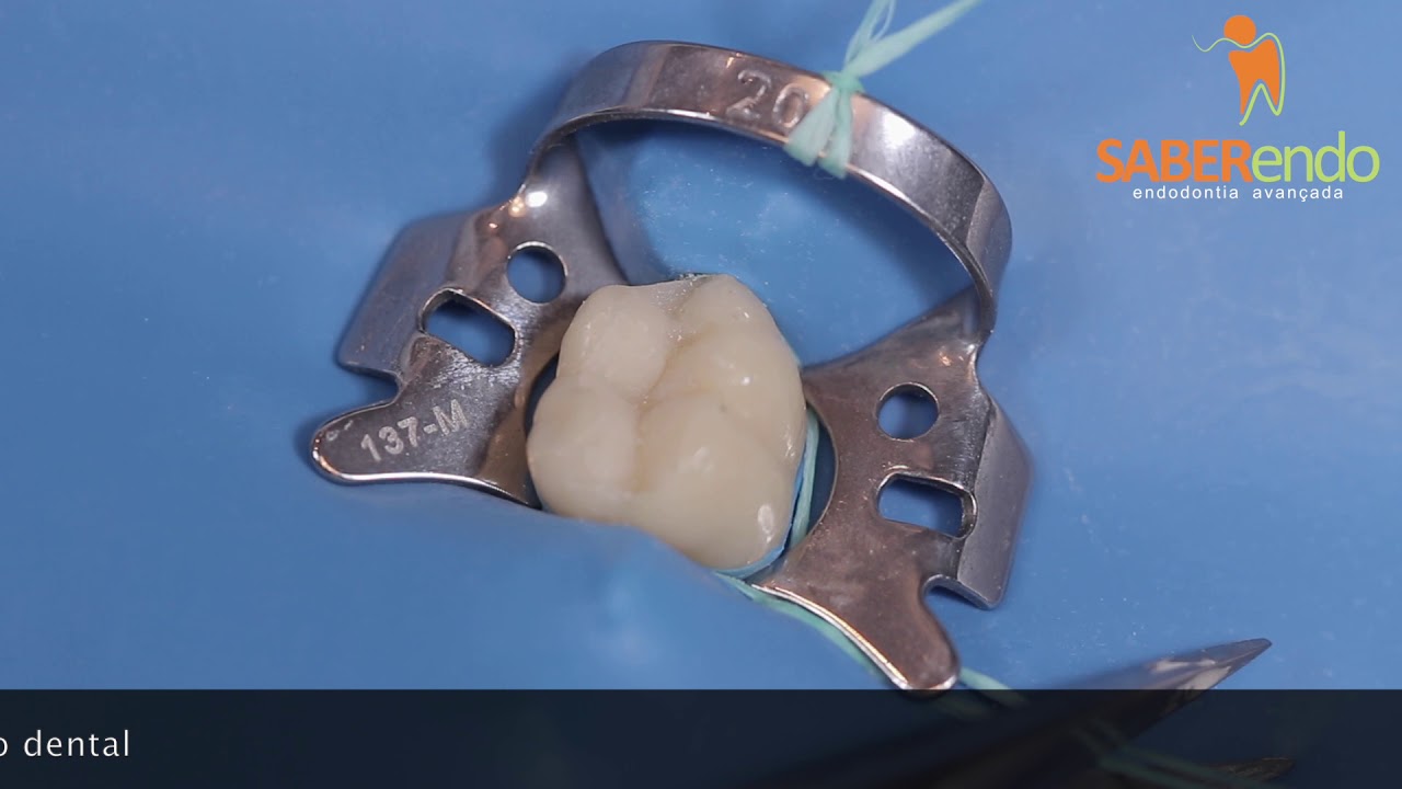 Isolamento absoluto em Endodontia.
