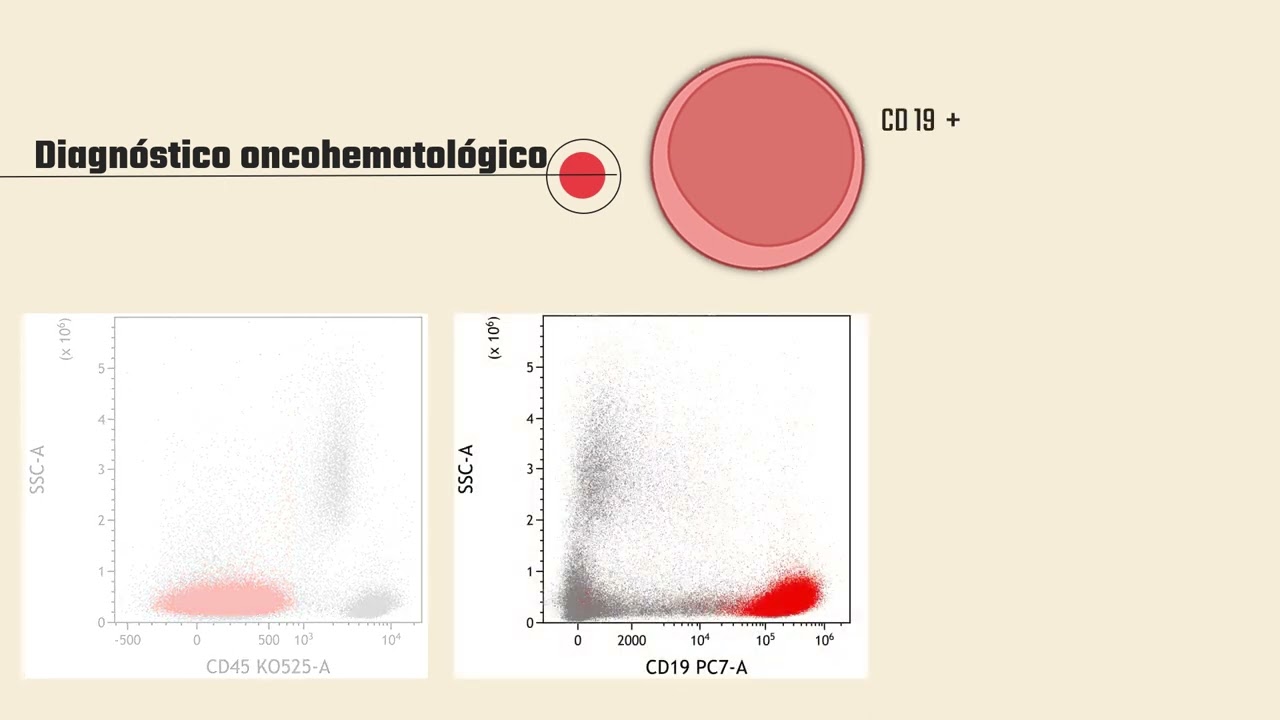 Enfermedad Mínima Residual en pediatría. Enfoque desde la citometría de flujo