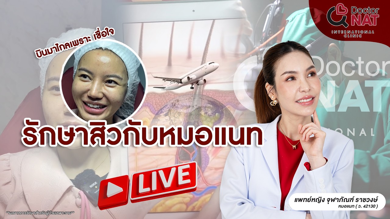 บินไกลเชื่อใจ รักษาสิวกับหมอแนท