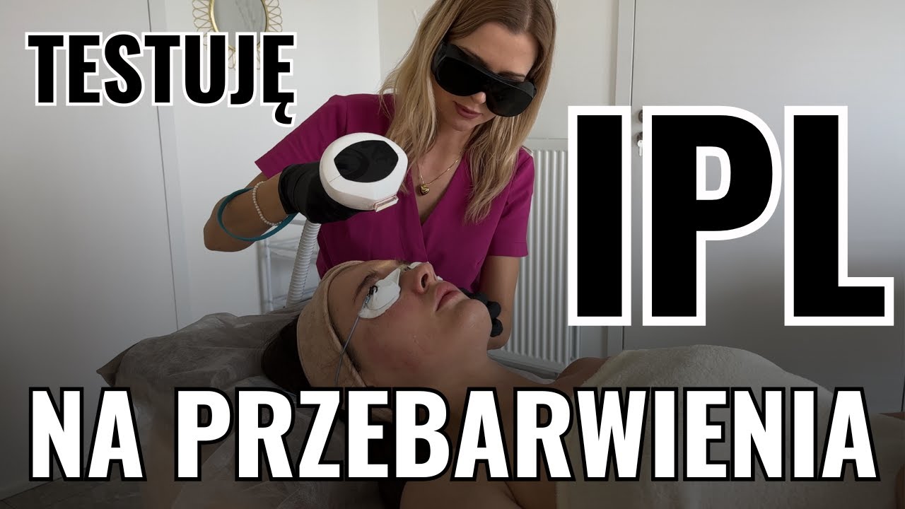 Przebarwienia: IPL w akcji! Cały zabieg i efekty przed/po😍