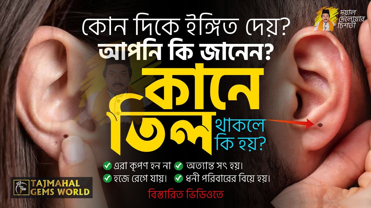 কানে তিল থাকলে কি হয়? দেহের কোথায় তিল থাকলে কি হয়? - Sorirer Kothay Til Thakle Ki Hoy!!