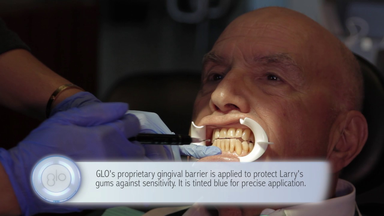 GLO Science Professional - Chairside Whitening with Larry Cohen