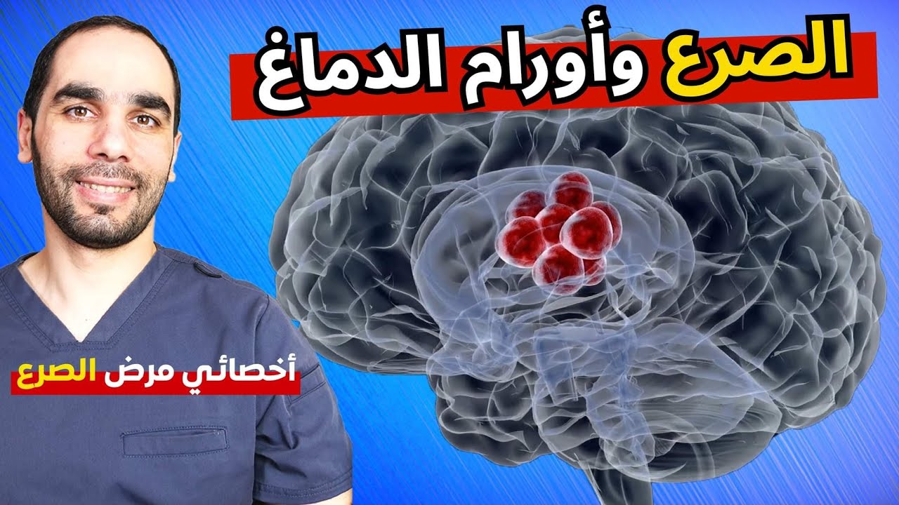 الصرع الناتج عن أورام الدماغ. علاج مختلف كليا عن الصرع العادي