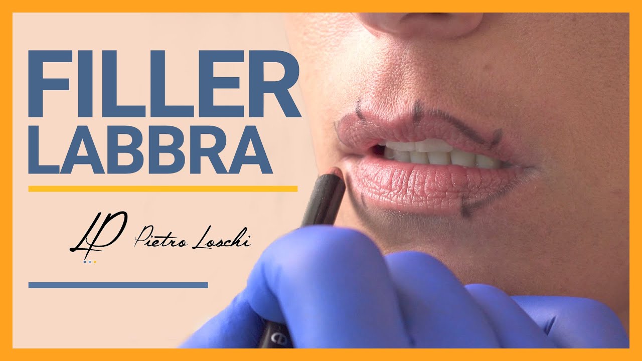 Medicina Estetica: il FILLER LABBRA - Pietro Loschi Chirurgo Plastico - Modena Bologna Milano