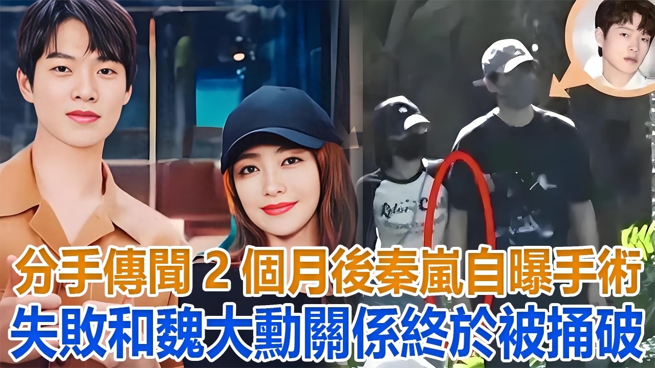 分手傳聞2個月後，秦嵐自曝手術失敗，和魏大勳關係終於被捅破！#秦嵐#魏大勳