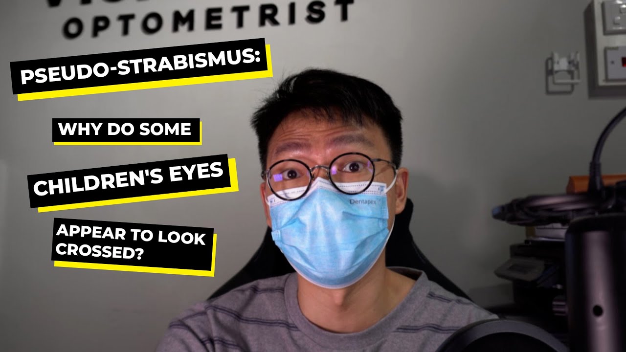 Pseudo-strabismus: Why do some children's eyes appear to look crossed?