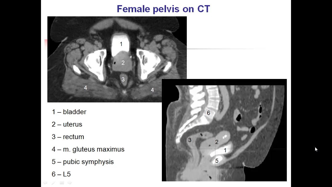 L7 Imaging of Genital System and Breast