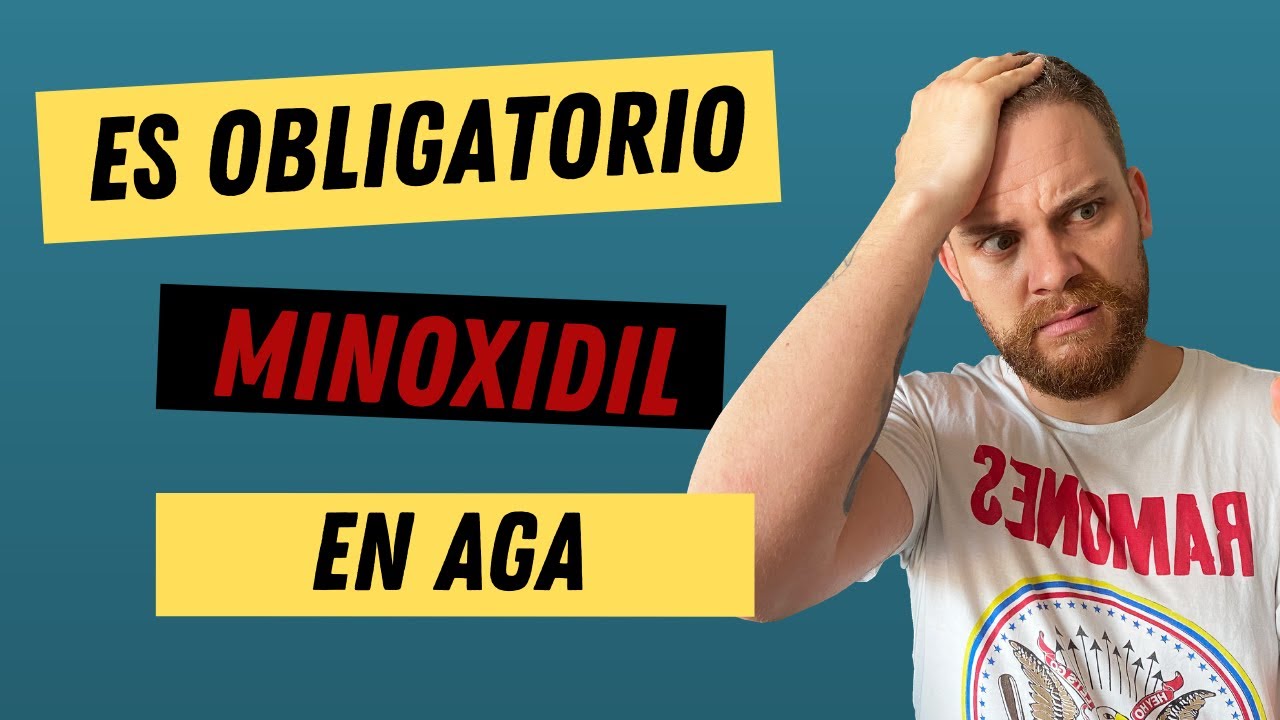 &iquest;ES OBLIGATORIO MINOXIDIL EN ALOPECIA ANDROGEN&Eacute;TICA?