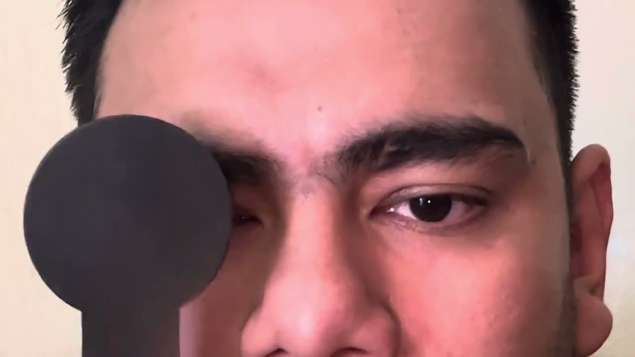 Prueba de Ángulo Kappa y Hischberg
