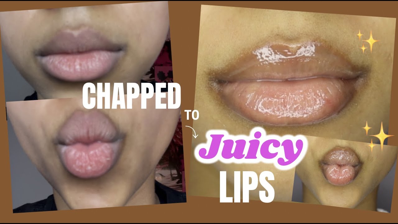 EASY LIPS ROUTINE for DRY, CHAPPED, PEELING LIPS **Gave me BOMB results** #drylipsremedy