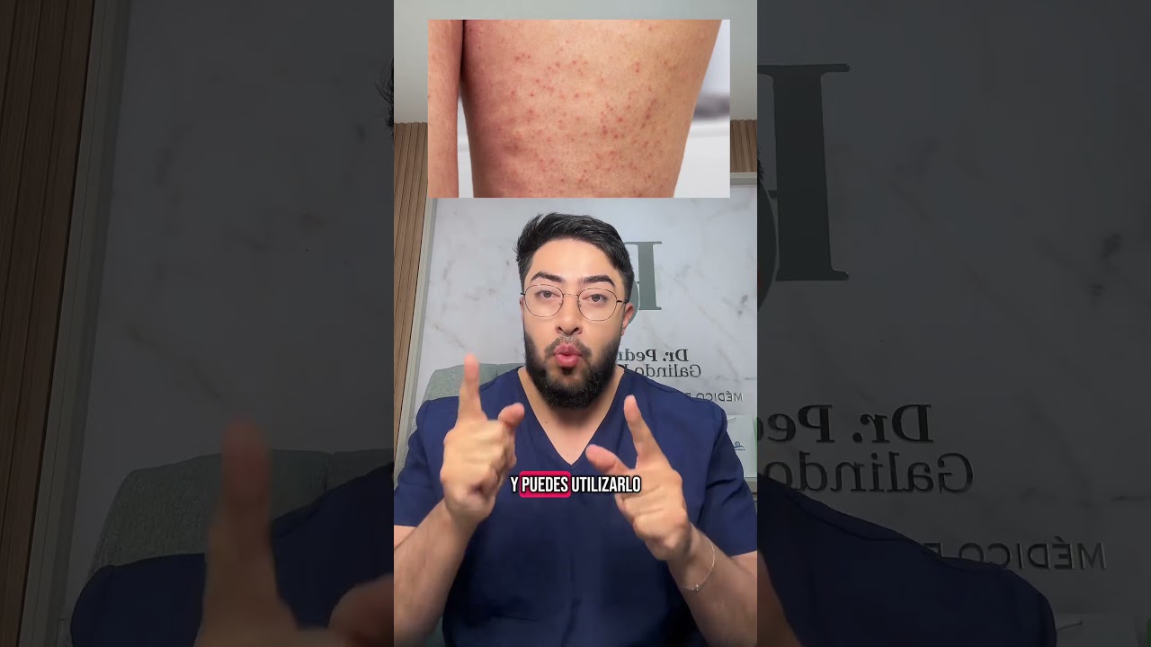 Granitos en los gl&uacute;teos #dermatologia #skincare #cosmeticdermatology #piel #foliculitis