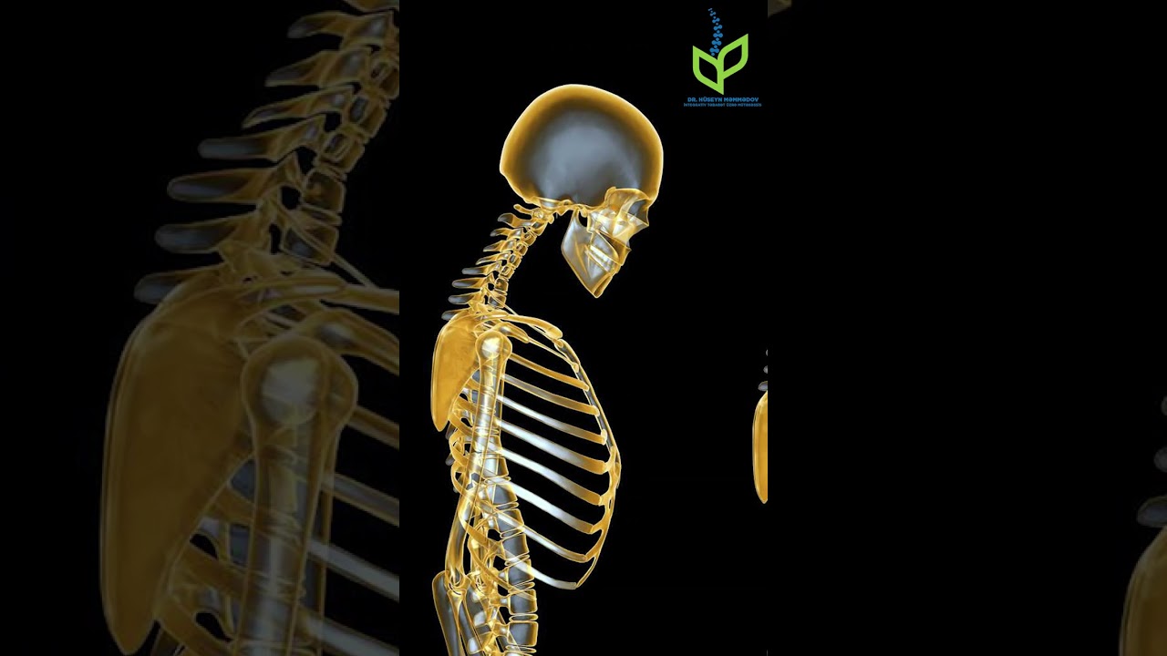 OSTEOPOROZ (SÜMÜK ƏRİMƏSİ) NƏDİR❓