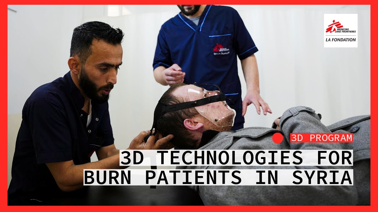 3D Program - 3D technologies for burn patients in Syria