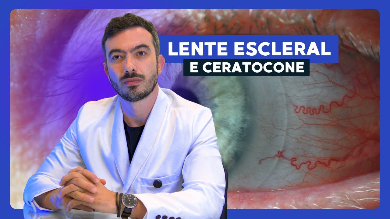 Não Aguento Lente Rígida no Ceratocone: O Que Fazer?