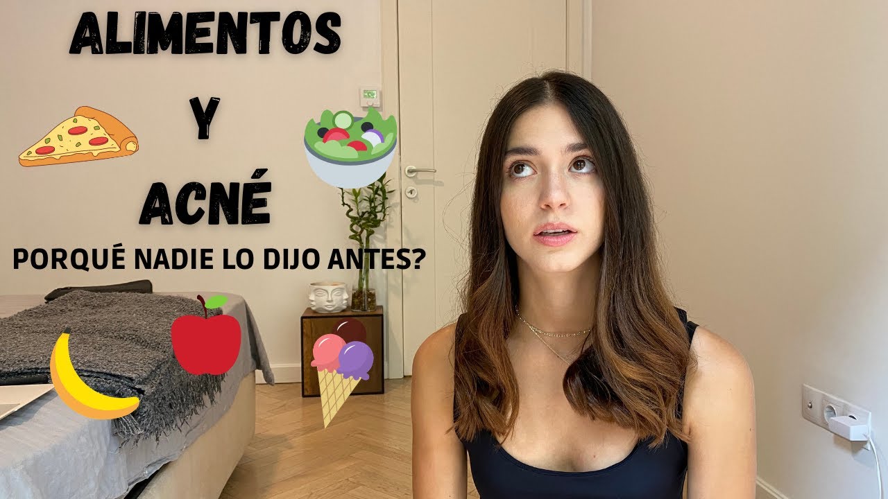 ALIMENTOS QUE NO DEBERÍAS CONSUMIR PARA EVITAR ACNÉ | Para personas que sufren de acné