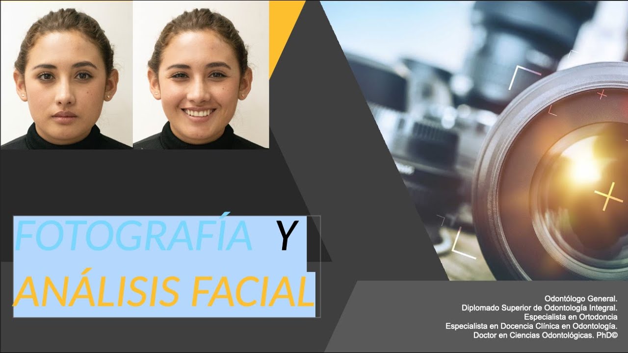 FOTOGRAFÍA  Y ANÁLISIS FACIAL EN ORTODONCIA ABO (American Board of Orthodontics)