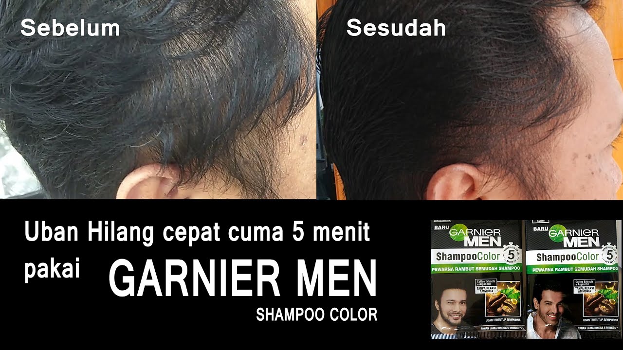 Uban Hilang cepat cuma 5 menit pake Garnier Men Shampoo Colour.