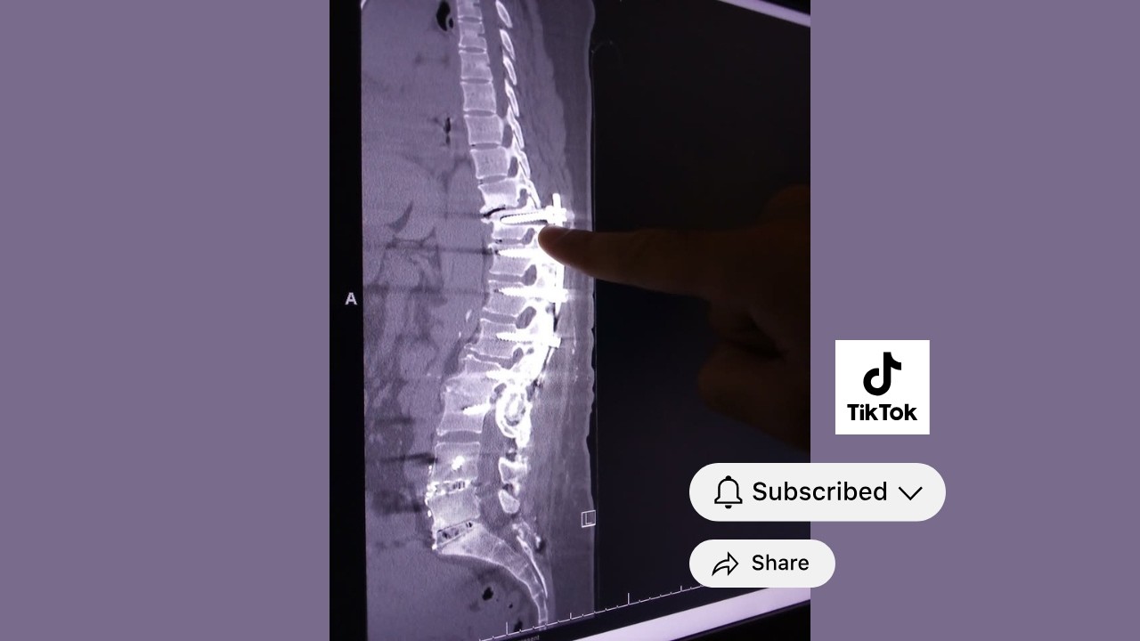 Do You Know How Much Your Spine Is Worth? 