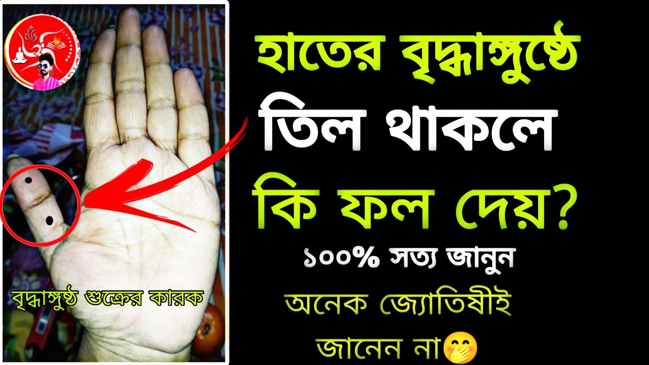 বুড়ো আঙুলে তিল|hate til thakle ki hoy|mole in thumb finger|kothay til thaka valo #moles