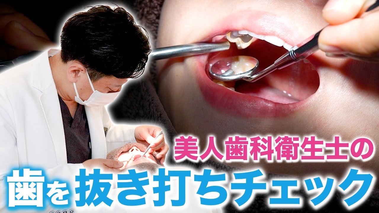 予告なし！抜き打ちチェックで歯医者スタッフの口腔内にまさかの...【審美歯科 歯列矯正 歯並び 歯科衛生士 虫歯】