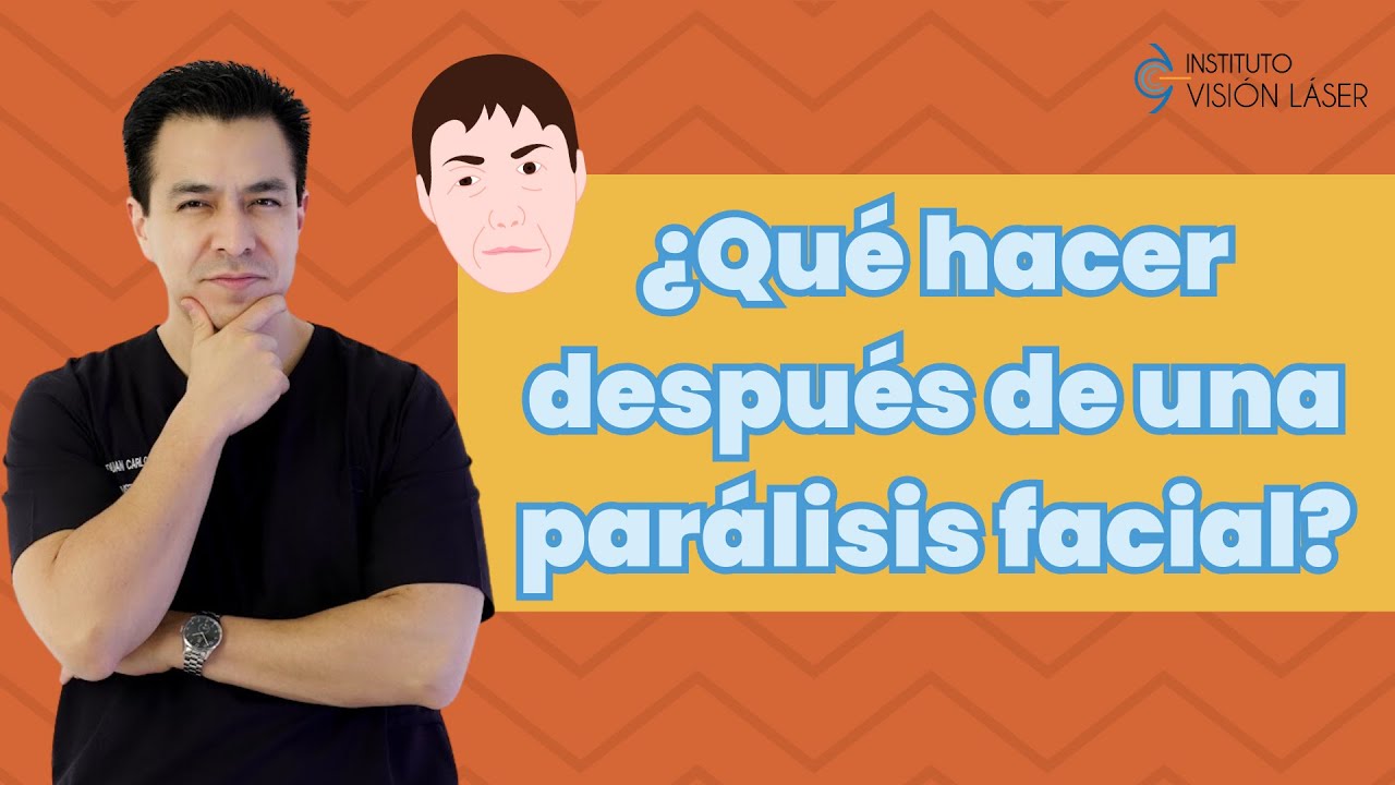 ¿ Qué hacer después de una parálisis facial?