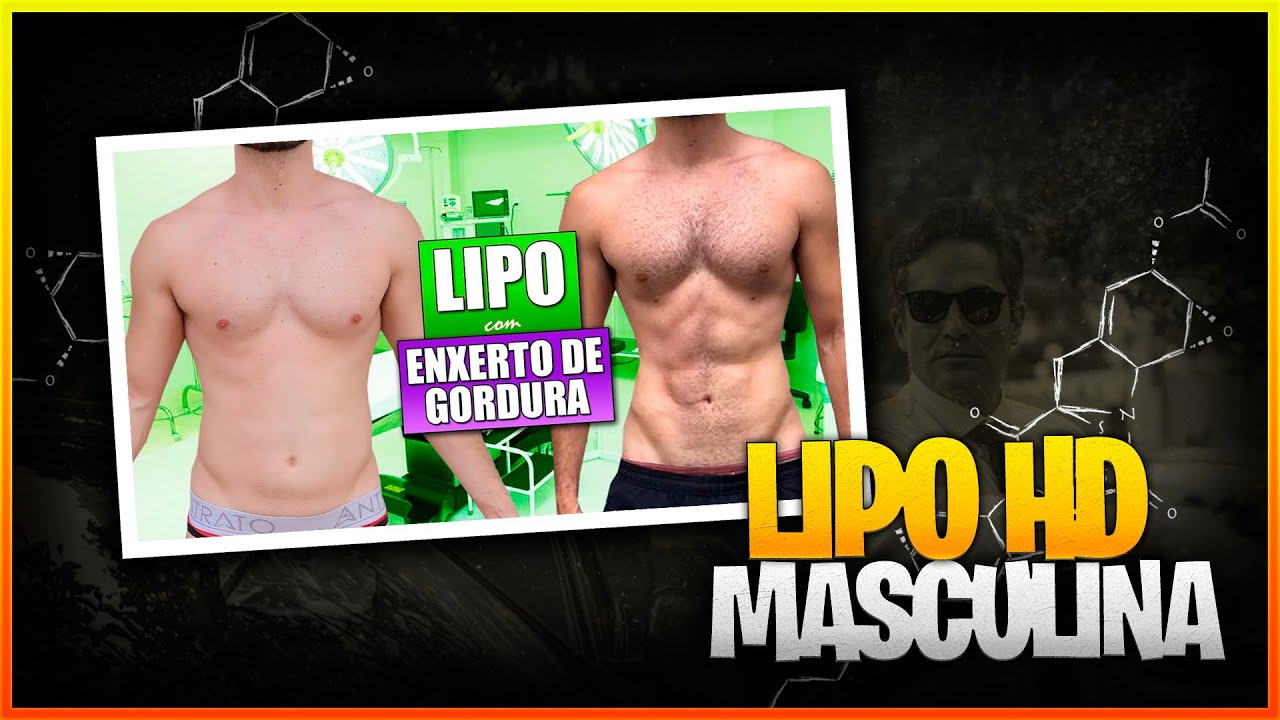 LIPO HD MASCULINA