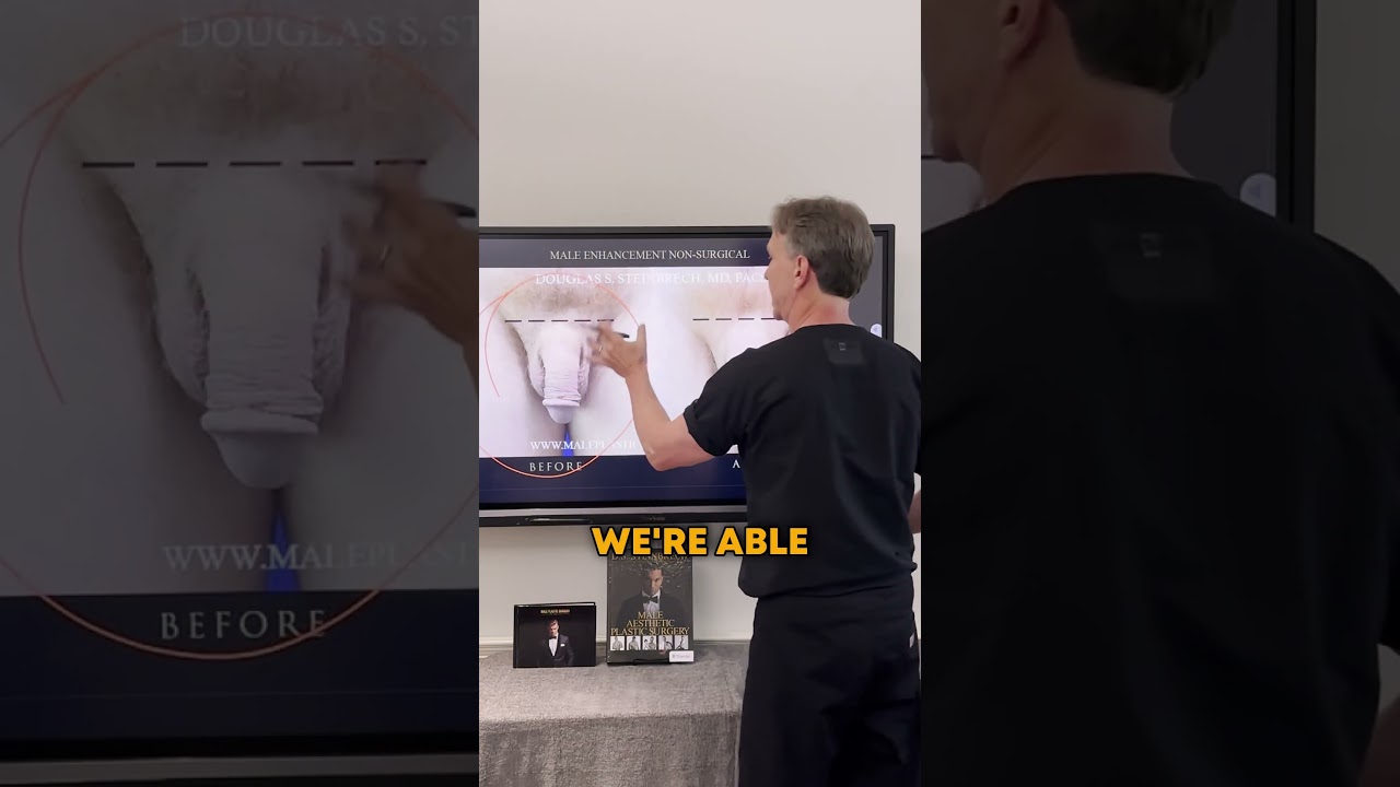 Male Enhancement GIRTH procedure