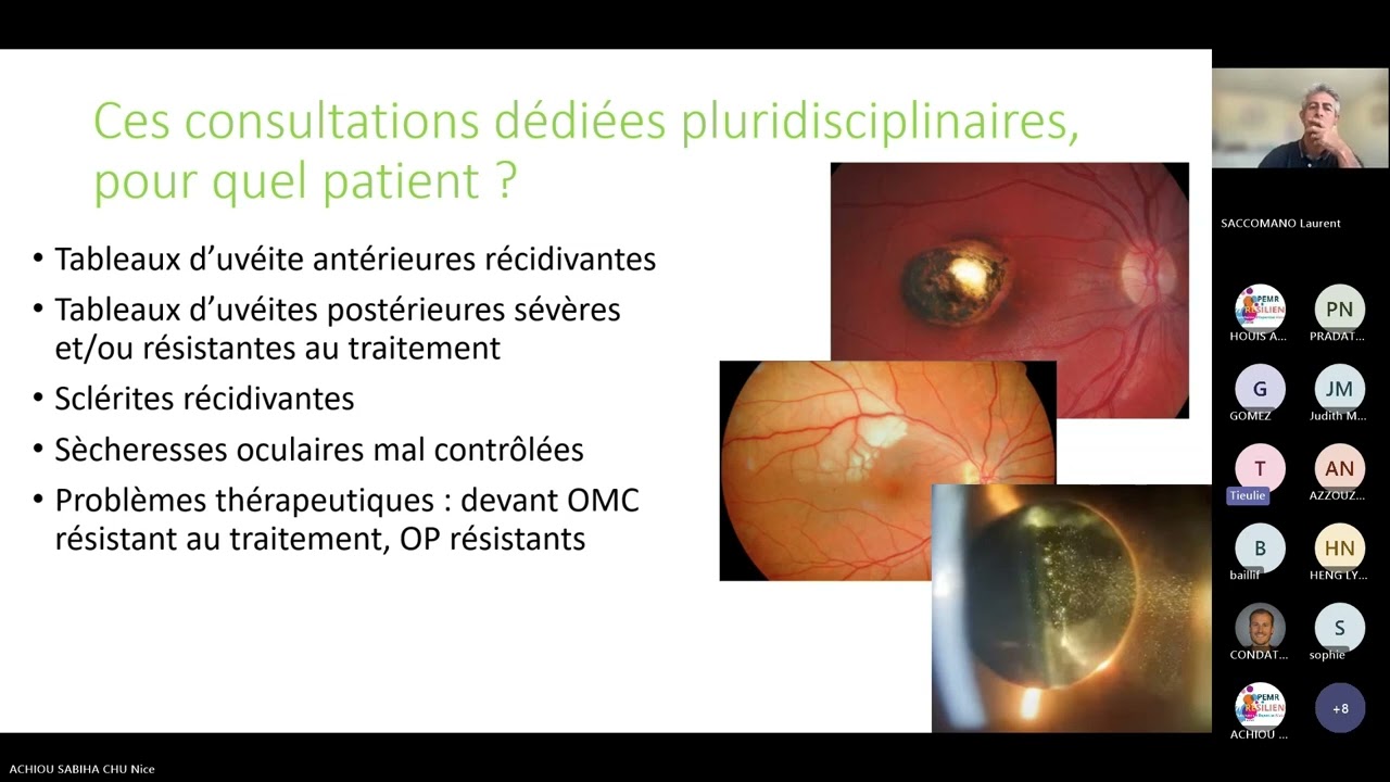Maladies oculaires rares inflammatoires centre de gestion des uv&eacute;ites- CHU de Nice