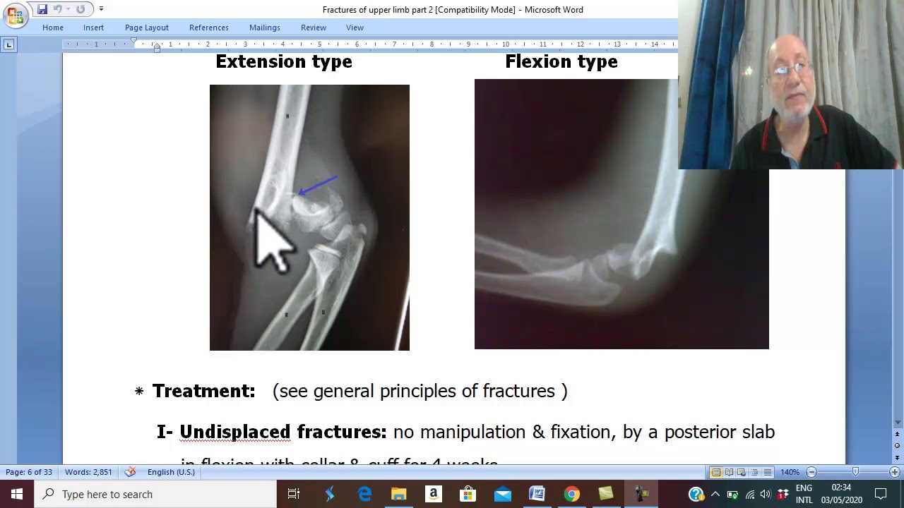 Orthopedic in Arabic 16  , ( Supracondylar fracture, part 2 ) , by Dr. Wahdan