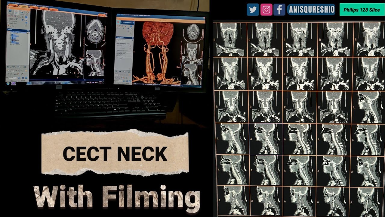 CECT Neck With Filming| By Anis Qureshi