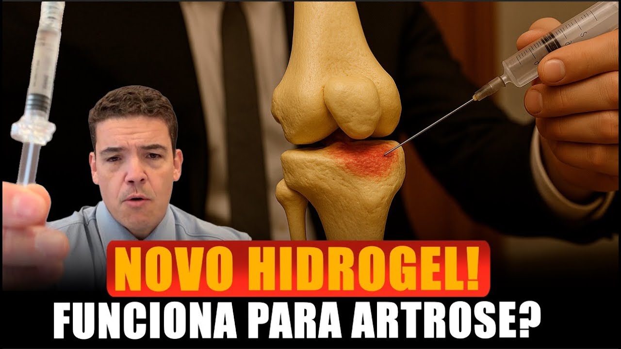 CONDROPATIAS E ARTROSE: O novo HIDROGEL FUNCIONA? 🤔
