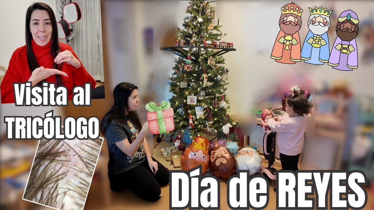 Vinieron los REYES 🎁 | Visita al TRICÓLOGO ¿por que se me cae el pelo?