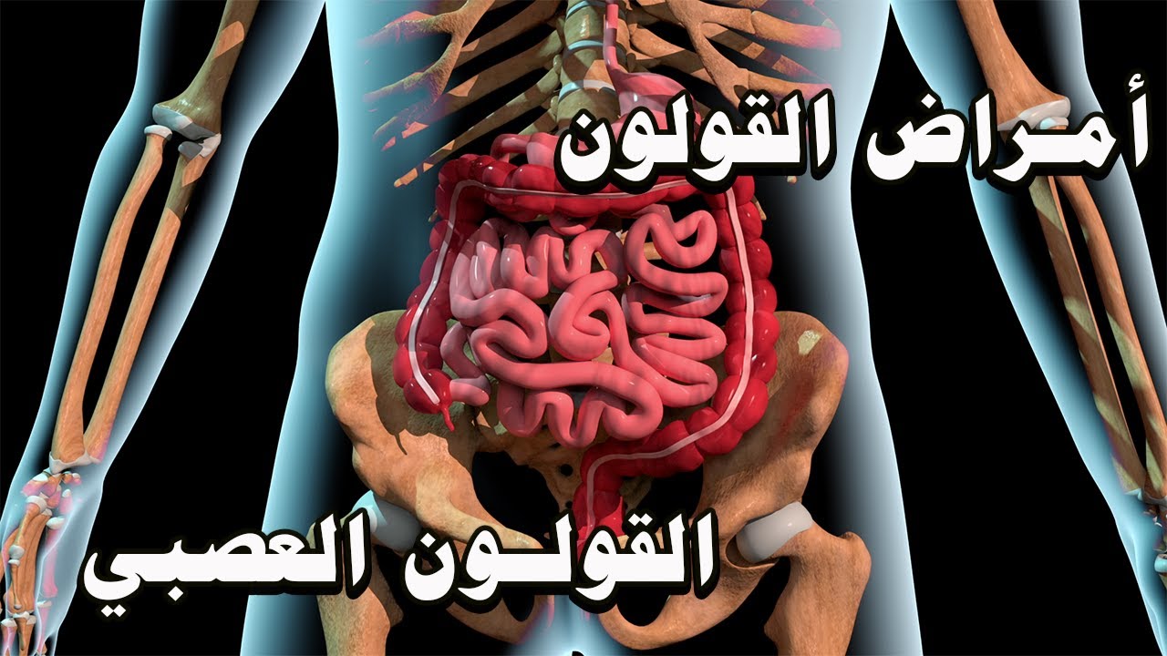 أهم أمراض القولون وأعراضها وعلاقتها بالقولون العصبي