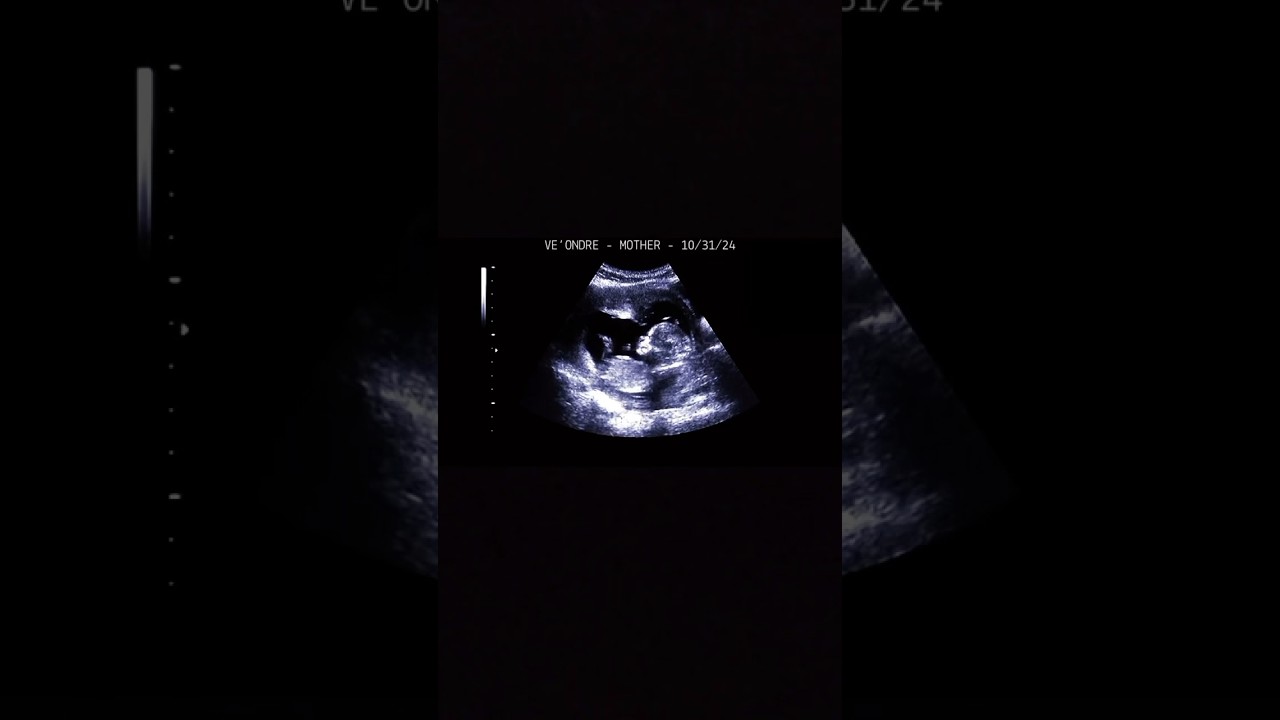 The first pregnant trans woman 🥹