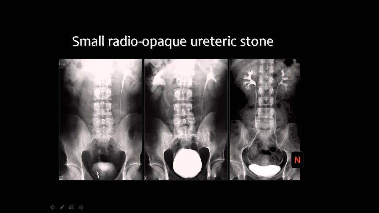 Urinary System Radiology (Arabic) - Prof. Mamdouh Mahfouz
