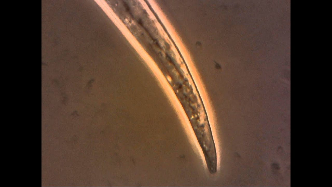 Cytoplasmic streaming in Arabidopsis Trichome