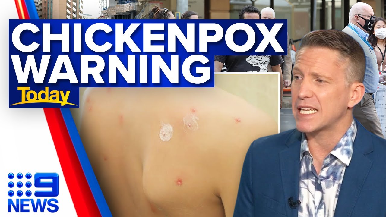 Surge in chickenpox infections in Queensland | 9 News Australia