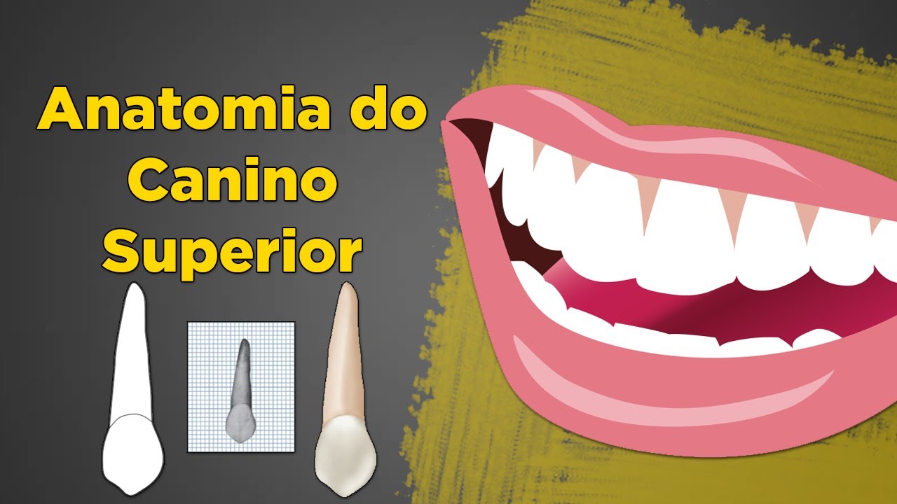 Anatomia do Canino Superior - Resumo de Anatomia Dental - Dente 13 e 23