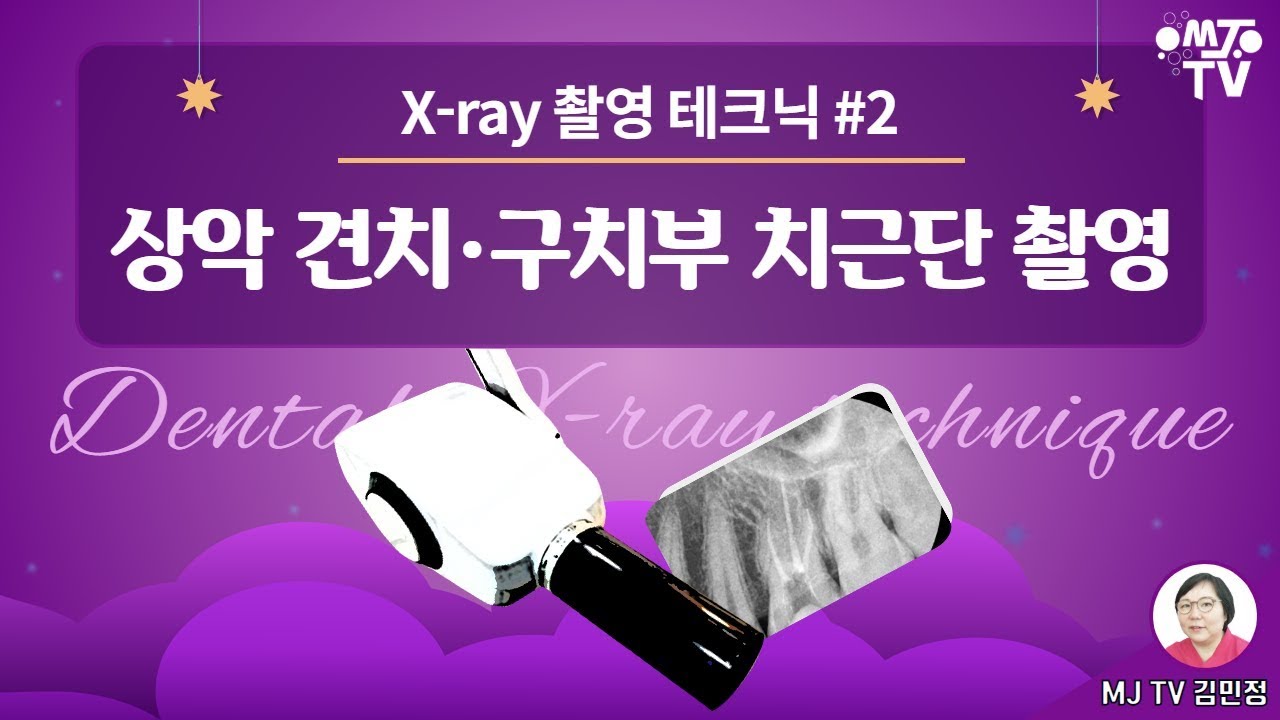 MJTV(엠제이티비) 18화-#치과위생사라면 꼭 알아야 할 X-ray 촬영 테크닉 #2 상악 견치·구치부 치근단 촬영 방법