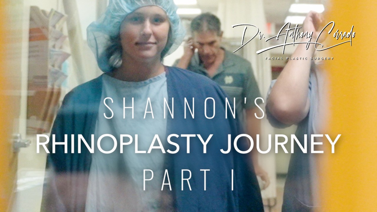 Shannon's Rhinoplasty Journey (Part 1) | Dorsal Hump + Bulbous Tip Fix with Dr. Corrado