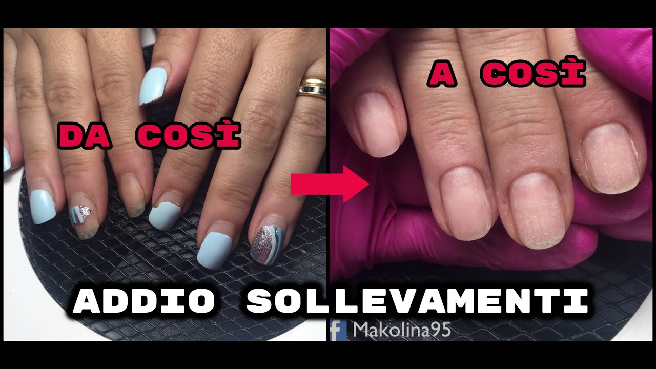‼️COME RICONOSCERE ED ELIMINARE I SOLLEVAMENTI+PREPARAZIONE UNGHIE AL REFILL|Makolina95|