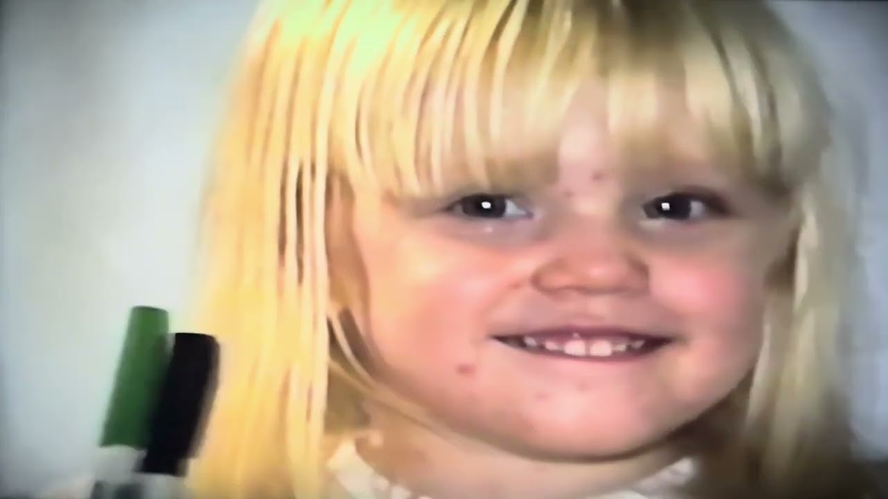 Lacey Chicken Pox