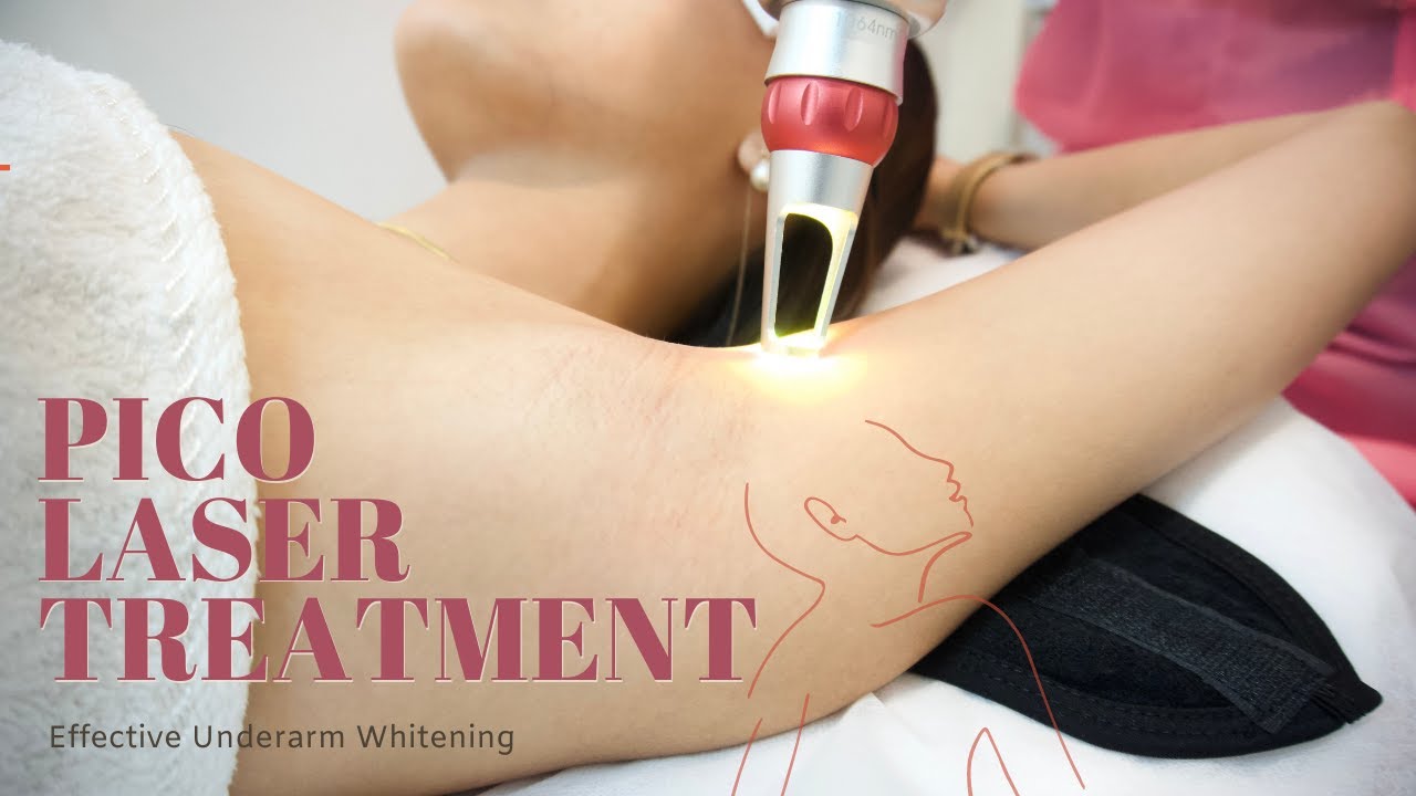 PICO LASER UNDERARM WHITENING | Mady Lim