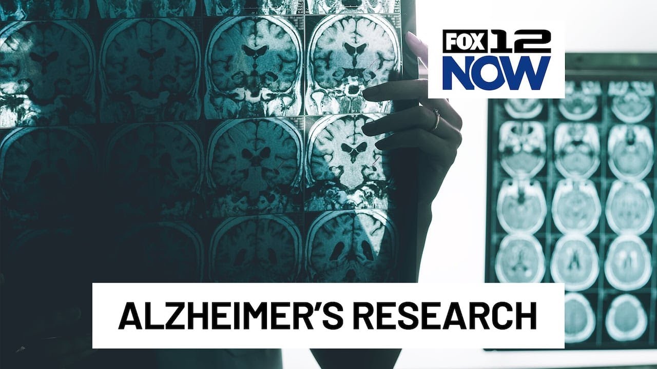 Study brings new insights into Alzheimer’s disease