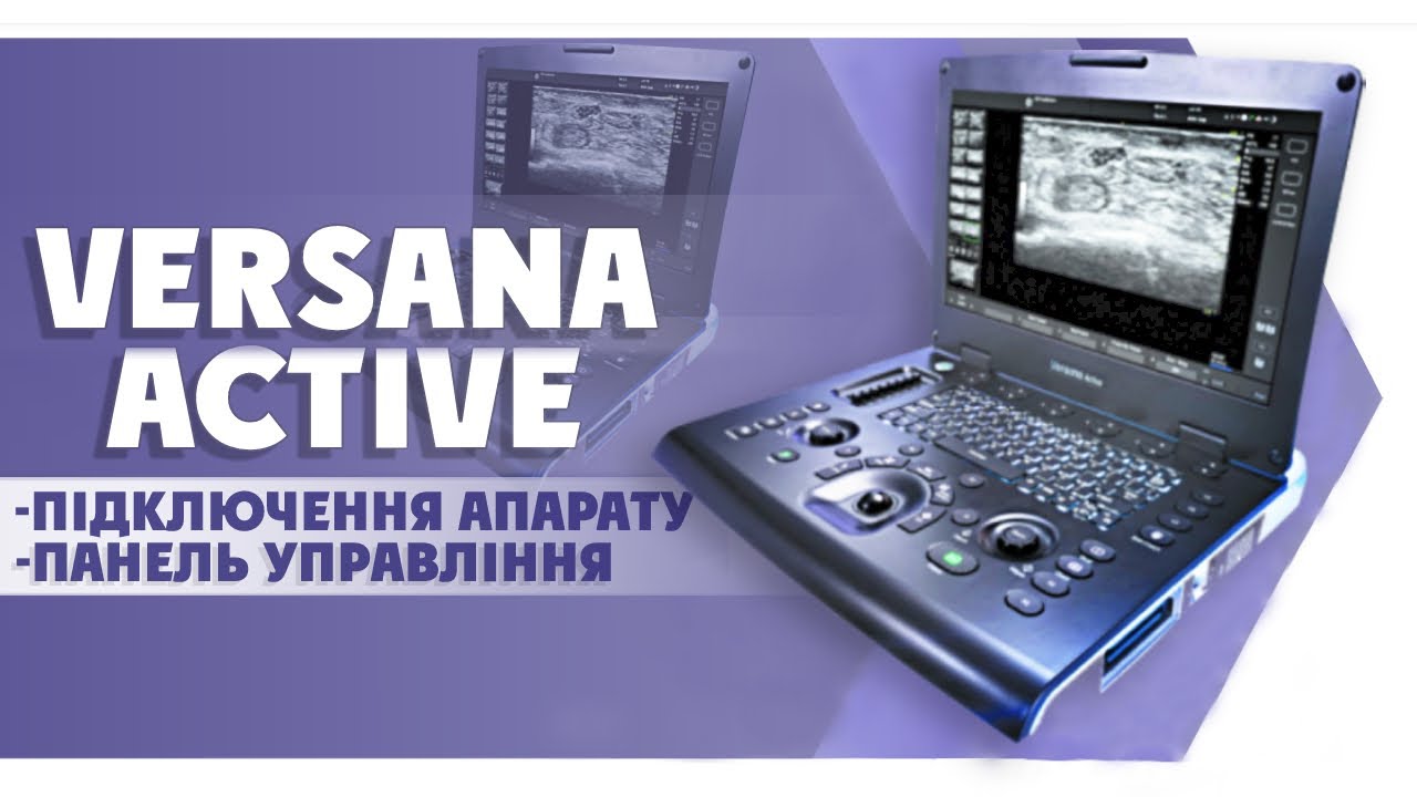 Підключення портативного УЗД VERSANA ACTIVE! Панель управління ультразвукової системи та її функції!